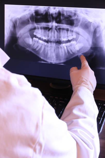 Best Emergency Dental Care for Abscessed Tooth in Myrtle Point, OR