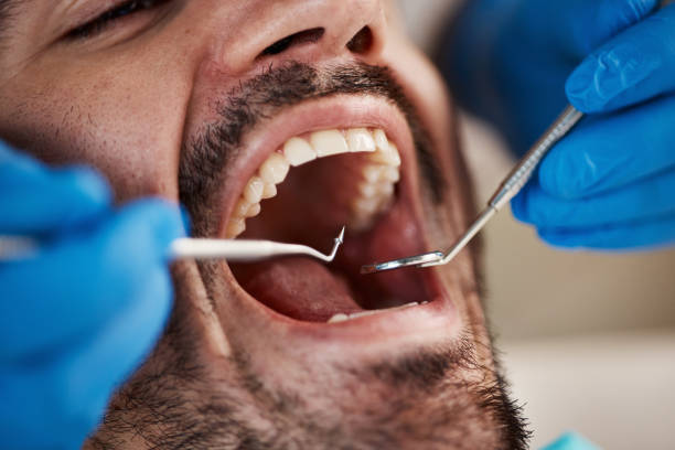 Best Emergency Dental Care for Abscessed Tooth in Myrtle Point, OR